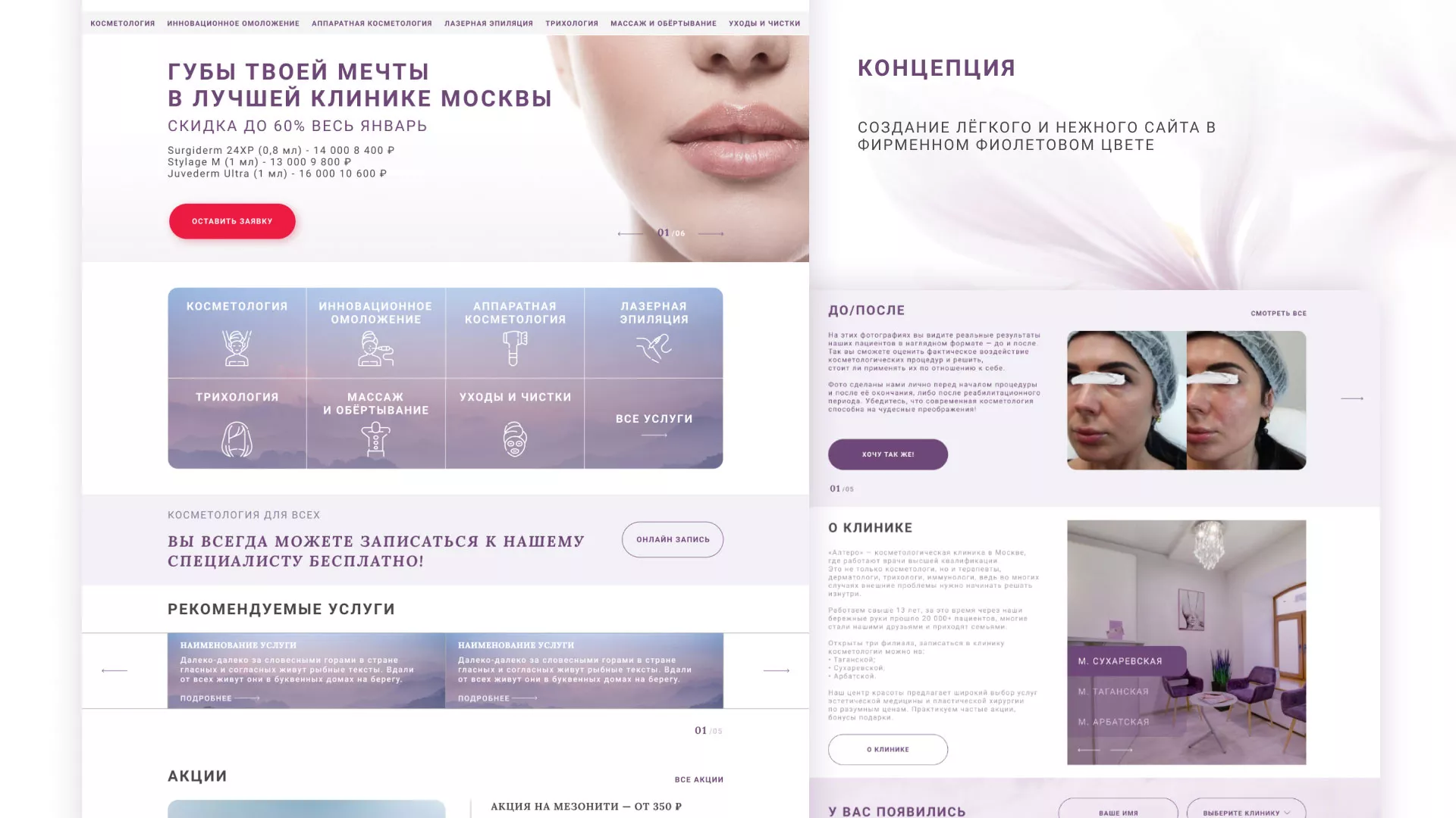 Создание сайта сети клиник эстетической косметологии «Алтеро» в Чёрмозе